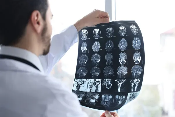 Brain Death Motor Vehicle Accident